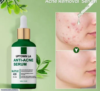 Clarifying Anti-Acne Serum – Targeted Blemish Control & Clear Skin Formula