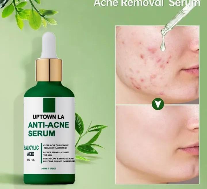 Clarifying Anti-Acne Serum – Targeted Blemish Control & Clear Skin Formula