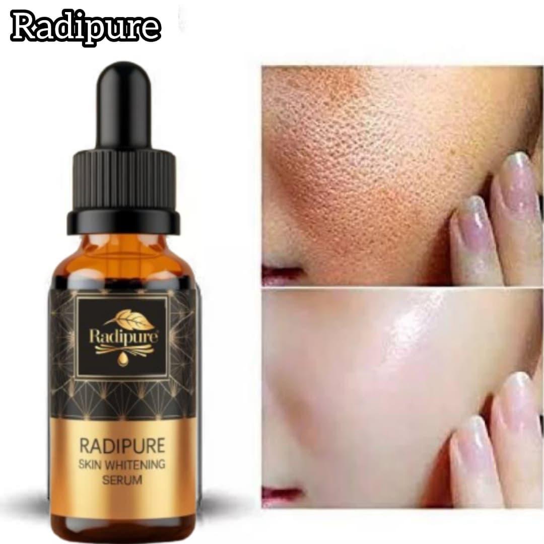 Glow & Renew Face Serum- Skin Brightening & Anti-Acne Formula