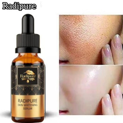 Glow & Renew Face Serum- Skin Brightening & Anti-Acne Formula