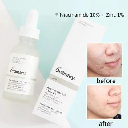 The Ordinary Serum – Advanced Skin Care for Clear, Healthy & Radiant Skin